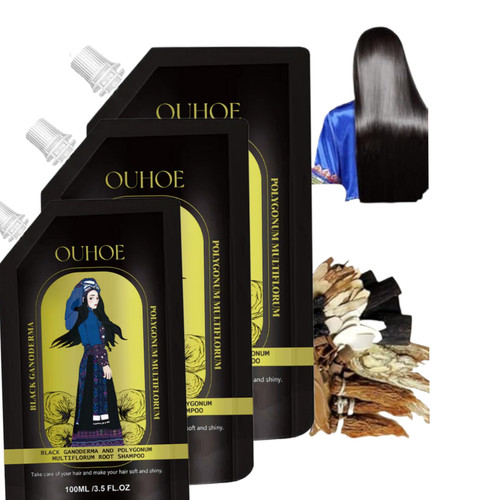 Anti Hair Loss Shampoo,Ginger Plant Extract Anti-Hair Loss Hair Shampoo,Ginger Shampoo for Hair Growth Oil Control Hair Care Plant Shampoo (3 pcs) Anti Hair Loss Shampoo,Ginger Plant Extract Anti-Hair Loss Hair Shampoo,Ginger Shampoo for Hair Growth Oil Control Hair Care Plant Shampoo (3 pcs)