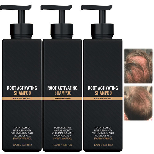SPARTAN Shampoo, SPARTAN Root Activator Shampoo, SPARTAN Hair Loss Shampoo, SPARTAN Hair Growth Shampoo, SPARTAN Shampoo Regrowth, Promotes Hair Growth (3pcs)