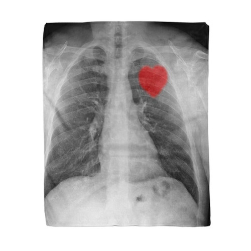 rouihot 50x60 Inches Throw Blanket Body Red Heart on X Ray Chest Bones Broken Warm Cozy Print Flannel Home Decor Comfortable Blanket for Couch Sofa Bed