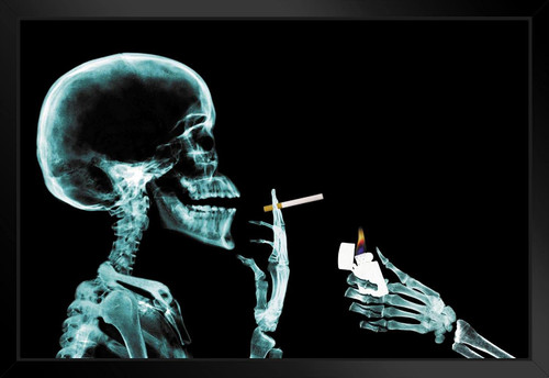 Skeleton Getting Cigarette Lit X Ray Photo Black Wood Framed Art Poster 20x14 Skeleton Getting Cigarette Lit X Ray Photo Black Wood Framed Art Poster 20x14