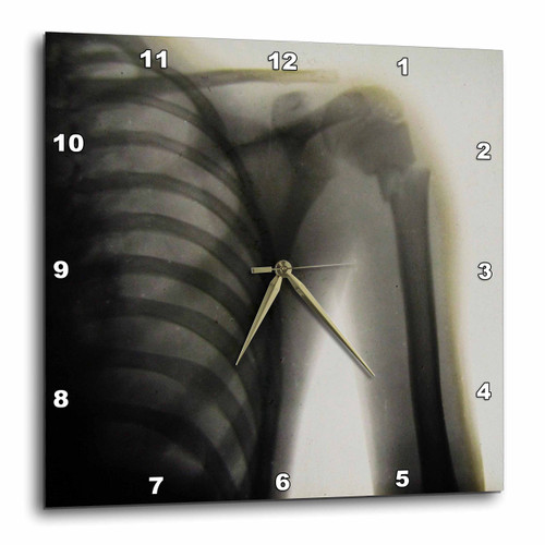 3D Rose Vintage Xray of a Human Shoulder Magic Lantern Slide Medical 1890 Wall Clock, 10" x 10"