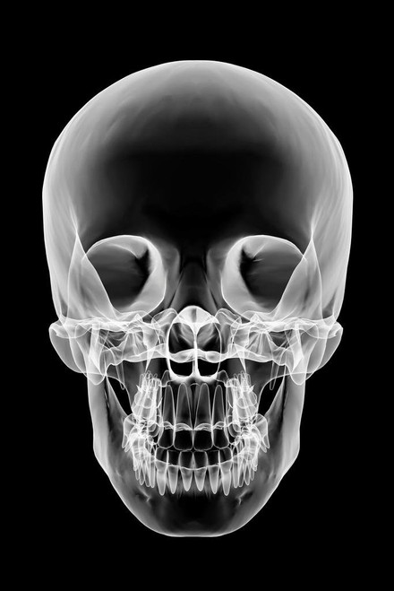 Laminated Human Skull Xray Art Print Large Dry Erase Sign 36x54