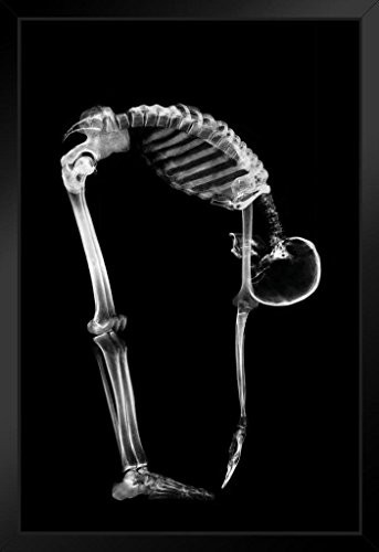 Skeleton Bending Forward Touching Toes X Ray Photo Art Print Framed Poster 14x20 inch