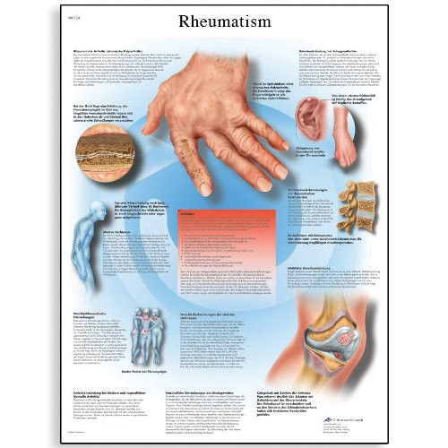 3B Scientific VR3124L Glossy UV Resistant Laminated Paper Enfermedades Reumaticas Anatomical Chart (Rheumatic Diseases Anatomical Chart, Spanish), Poster Size 20" Width x 26" Height