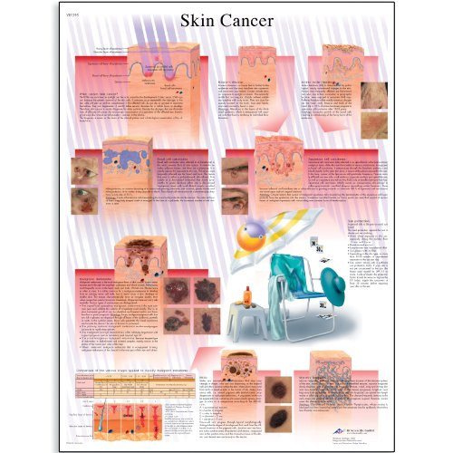 3B Scientific VR1295L Glossy Laminated Paper Skin Cancer Anatomical Chart, Poster Size 20" Width x 26" Height