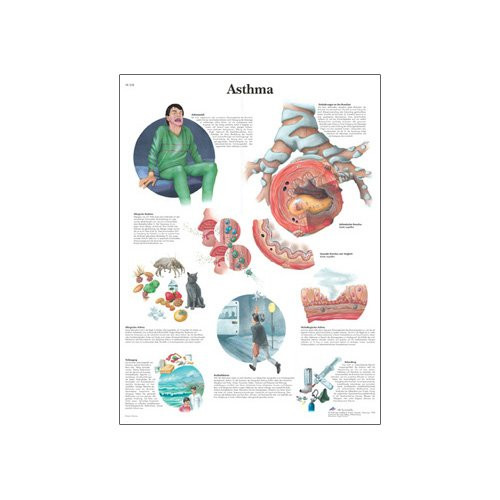 3B Scientific VR3328L Glossy UV Resistant Laminated Paper Asma Anatomical Chart (Asthma Anatomical Chart, Spanish), Poster Size 20" Width x 26" Height 3B Scientific VR3328L Glossy UV Resistant Laminated Paper Asma Anatomical Chart (Asthma Anatomical Chart, Spanish), Poster Size 20" Width x 26" Height