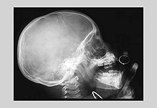 Buyenlarge 0-587-11741-9-P1827 Skull and Hand Paper Poster, 18" x 27"