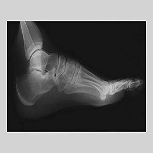 Buyenlarge 0-587-11742-7-G1827 'Foot' Giclee Fine Art Print, 18" x 27" Buyenlarge 0-587-11742-7-G1827 'Foot' Giclee Fine Art Print, 18" x 27"