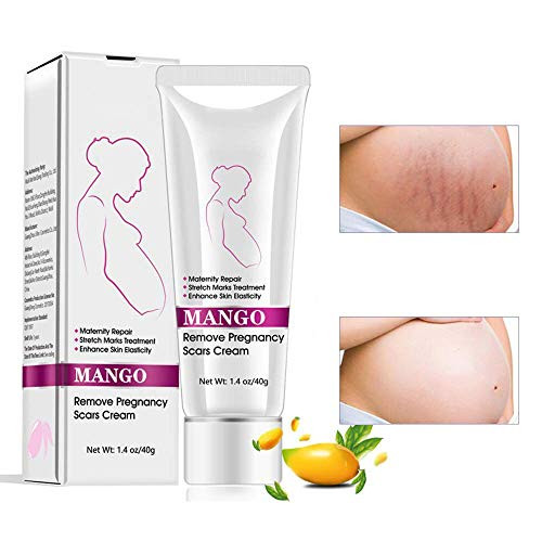 Stretch Mark Scar Cream Remove Pregnancy ScarsStretch Marks Treatment Maternity RepairRemove Stretch Marks from Pregnancy Repair Scar Slack Line Abdomen Stretch Marks