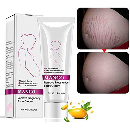Stretch Mark Cream Treatment Stretch Marks Scar Belly Creams for Wrinkles Repair Scar Slack Line Abdomen Postpartum Obesity Stretch Mark Moisturizing Remove Marks  M