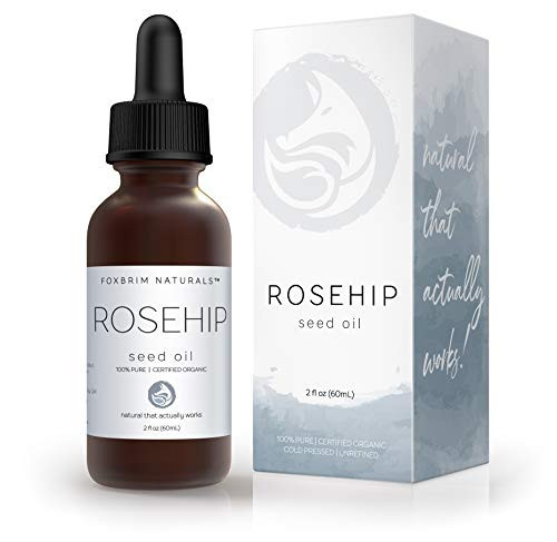 Organic Rosehip Oil  Cold Pressed Natural  Unrefined  Certified USDA Virgin Rose Hip Seed Oil Best Moisturizer for Hair Skin Face Nails  Essential Wrinkles Fine Lines  Scars  2oz