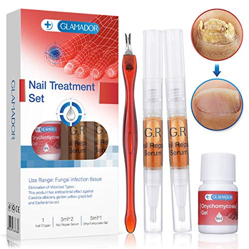 Nail Repair PenGLAMADOR Effective Nail Treatment Set Toenail and Nail Care Solution Strengthen and Repairs Damaged Brittle Nails 2 Pens included Nail Repair PenGLAMADOR Effective Nail Treatment Set Toenail and Nail Care Solution Strengthen and Repairs Damaged Brittle Nails 2 Pens included