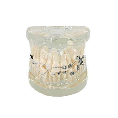 YOUYA DENTAL TM 211 Demonstration Orthodontic Model Transparent Teeth Teach Study Tools with Metal and Ceramic Bracket Transparent
