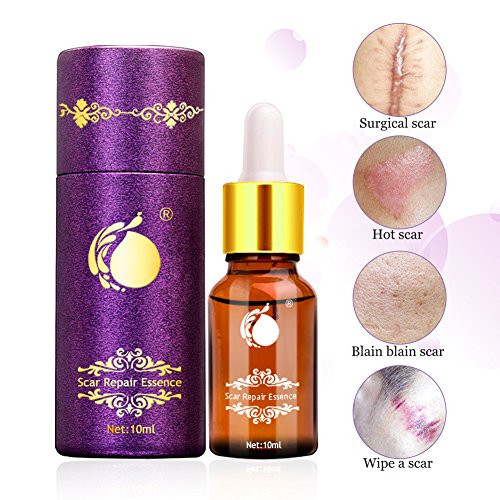 Scar Repair Oil  Sky-shop Anti Aging Scar Healing Lavender Facial Oil Repairs Damaged Skin  Scar Treatment for Acne and Stretch Marks 10ml Scar Repair Oil  Sky-shop Anti Aging Scar Healing Lavender Facial Oil Repairs Damaged Skin  Scar Treatment for Acne and Stretch Marks 10ml