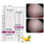 RtopR Stretch Mark Cream For Pregnancy Repair Scar Slack Line Abdomen Stretch Marks Cream Remove Stretch Marks From Pregnancy Repair Scar Slack Line Abdomen Stretch Marks Postpartum