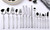 HIDEERPPY Silverware Set, 15-piece 304 Stainless Steel Cutlery Steak Knife, Fork And Spoon Dessert Knife, Fork And Spoon Set, Flatware Set (Color : Silver, Size : 1Set)
