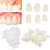 Brige Temporary Tooth Repair kit for Fix Filling the Missing Broken Tooth and Gaps-Moldable Fake Teeth Veneers and Thermal Beads Replacement Kit,Artfifical Teeth