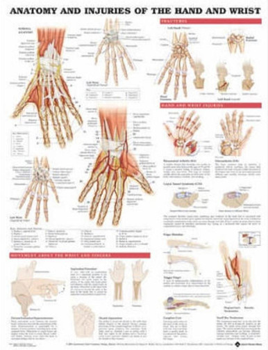 Anatomy and Injuries of the Hand and Wrist Anatomical Chart 20" X 26 ...