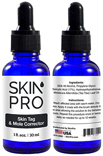 Skinpro Skin Tag Remover And Mole Corrector For Fast Removal Of Skin Moles Skin Tags Warts And