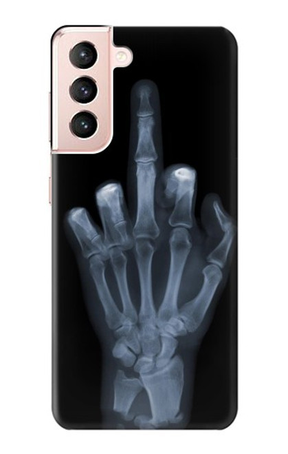 S1143 X-ray Hand Middle Finger Case For Samsung Galaxy S21 5G