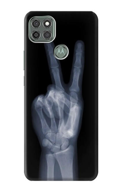 S3101 X-ray Peace Sign Fingers Case For Motorola Moto G9 Power