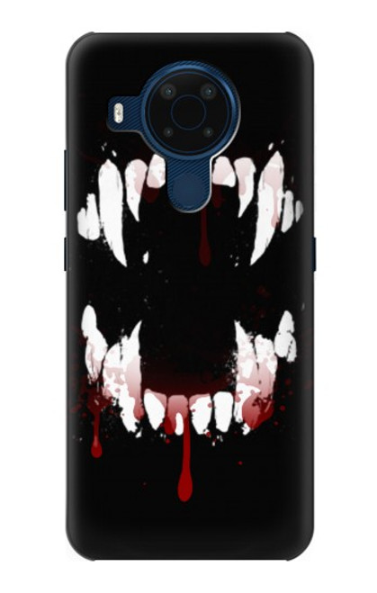S3527 Vampire Teeth Bloodstain Case For Nokia 5.4