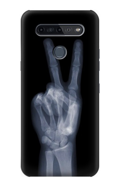 S3101 X-ray Peace Sign Fingers Case For LG K51S