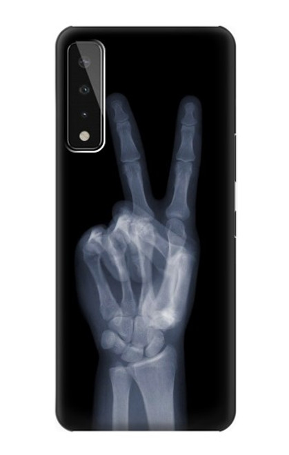 S3101 X-ray Peace Sign Fingers Case For LG Stylo 7 5G