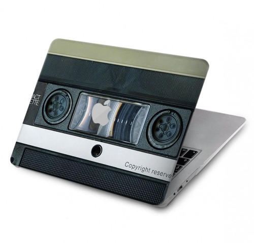 S1872 VDO Tape Hard Case For MacBook Pro Retina 13″ - A1425, A1502