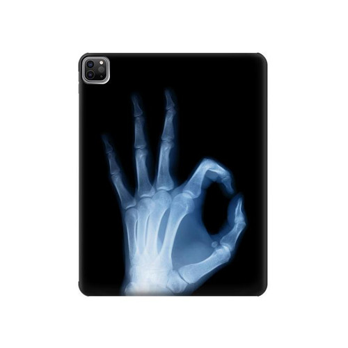 S3239 X-Ray Hand Sign OK Hard Case For iPad Pro 12.9 (2022,2021,2020,2018, 3rd, 4th, 5th, 6th)