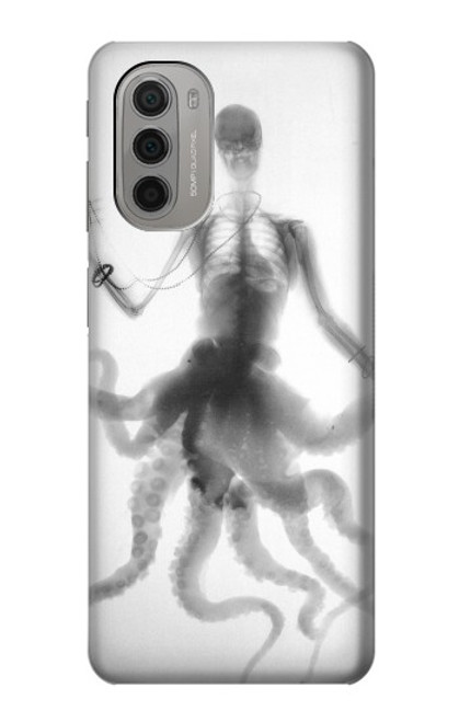 S1432 Skull Octopus X-ray Case For Motorola Moto G51 5G