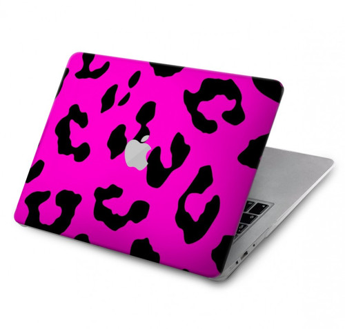 S1850 Pink Leopard Pattern Hard Case For MacBook Pro 16 M1,M2 (2021,2023) - A2485, A2780