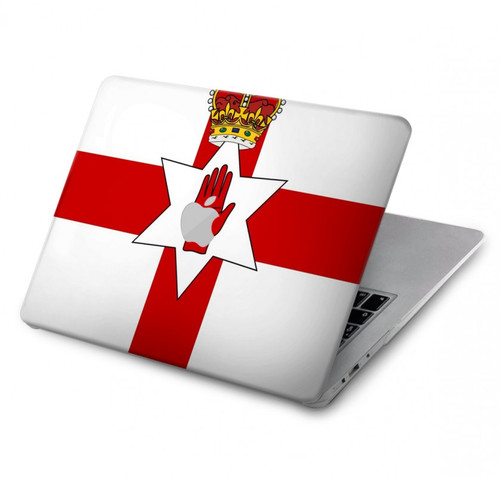 S3089 Flag of Northern Ireland Hard Case For MacBook Pro 16 M1,M2 (2021,2023) - A2485, A2780