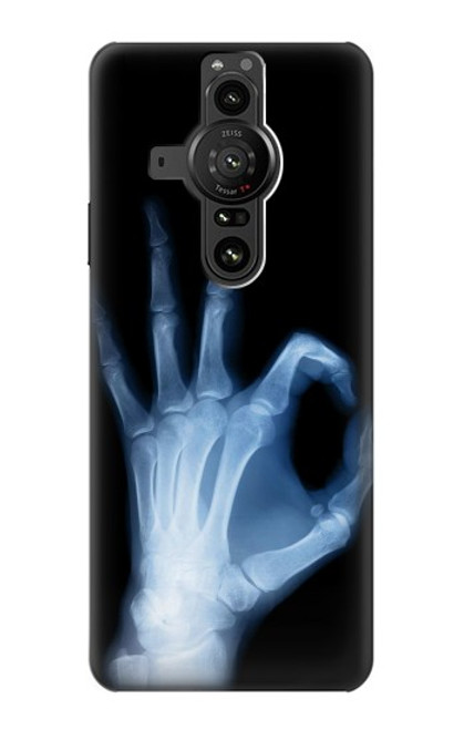S3239 X-Ray Hand Sign OK Case For Sony Xperia Pro-I
