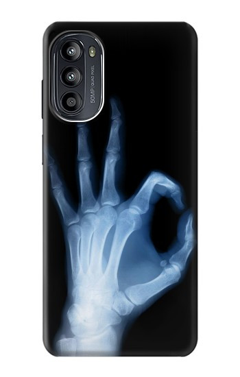 S3239 X-Ray Hand Sign OK Case For Motorola Moto G52, G82 5G