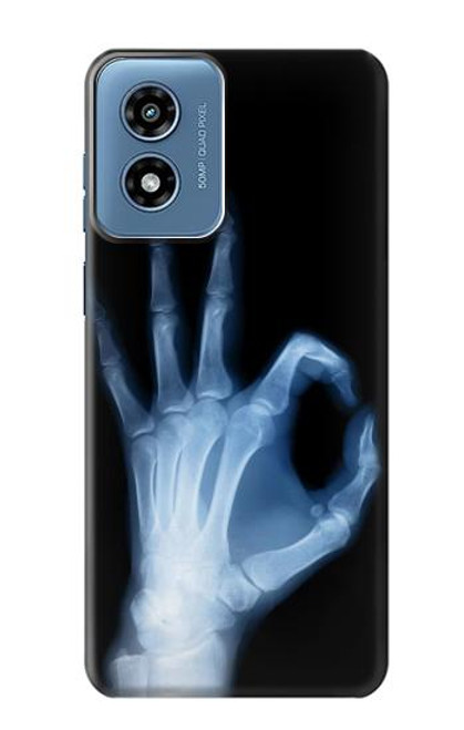 S3239 X-Ray Hand Sign OK Case For Motorola Moto G Play 4G (2024)