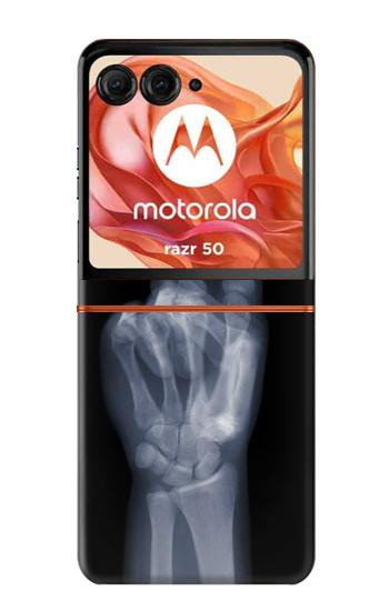 S3101 X-ray Peace Sign Fingers Case For Motorola Razr 70,60,50, Razr (2026, 2025, 2024)