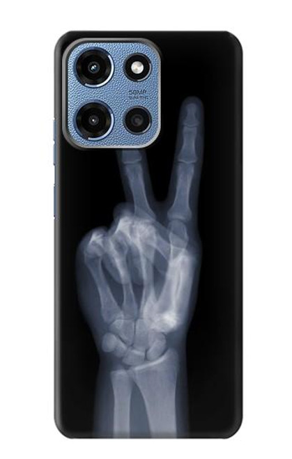 S3101 X-ray Peace Sign Fingers Case For Motorola Moto G 5G (2025)