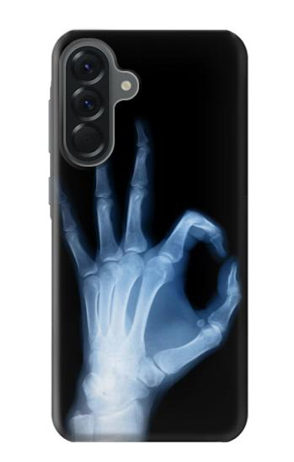 S3239 X-Ray Hand Sign OK Case For Samsung Galaxy A56 S3239 X-Ray Hand Sign OK Case For Samsung Galaxy A56