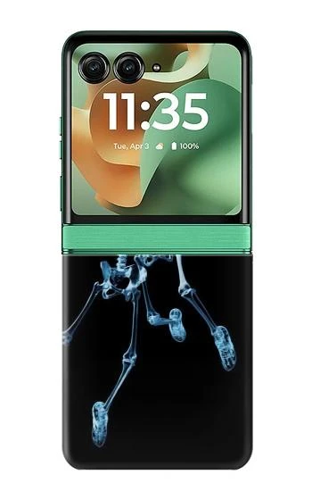 S1111 Soccer X-ray Case For Motorola Razr 70+,60+, Razr+ (2026, 2025, 2024)