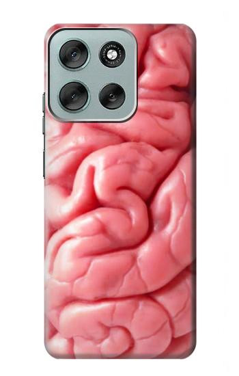 S0339 Brain Case For Motorola Moto G56