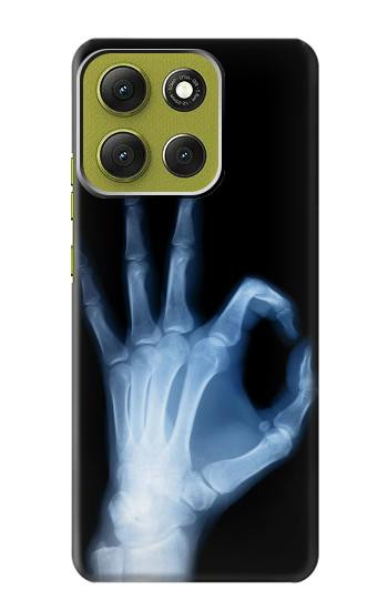 S3239 X-Ray Hand Sign OK Case For Motorola Moto G86