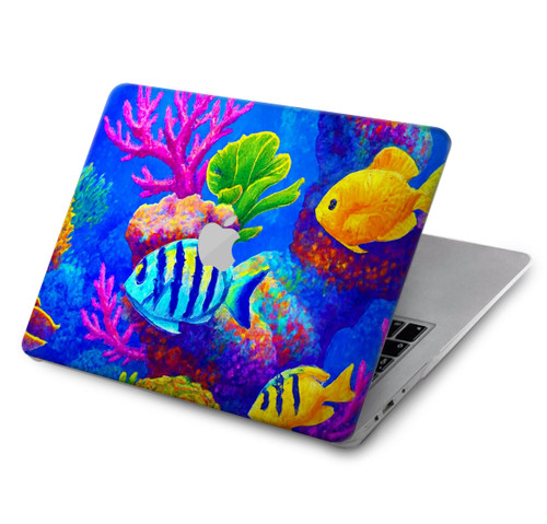 S4058 Colorful Aquarium Hard Case For MacBook Air 13″ (2022,2025) - A2681, A3113, A3240