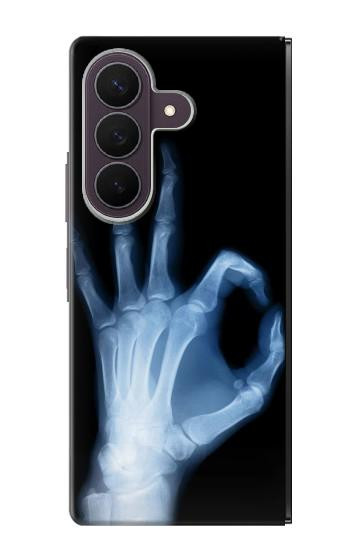 S3239 X-Ray Hand Sign OK Case For Samsung Galaxy Z Fold 8 Ultra