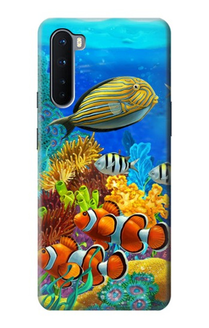 S2568 Sea Seabed Fish Corals Underwater Ocean Case For OnePlus Nord