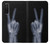S3101 X-ray Peace Sign Fingers Case For Sony Xperia 5 II