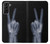 S3101 X-ray Peace Sign Fingers Case For Samsung Galaxy S21 Plus 5G, Galaxy S21+ 5G