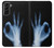 S3239 X-Ray Hand Sign OK Case For Samsung Galaxy S21 Plus 5G, Galaxy S21+ 5G