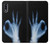 S3239 X-Ray Hand Sign OK Case For Sony Xperia L5