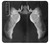 S1593 Ballet Pointe Shoe Case For Sony Xperia 1 III